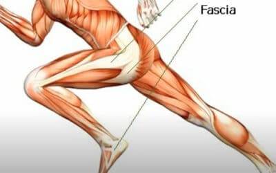 MANAGEMENT OF LOWER LIMB PAIN